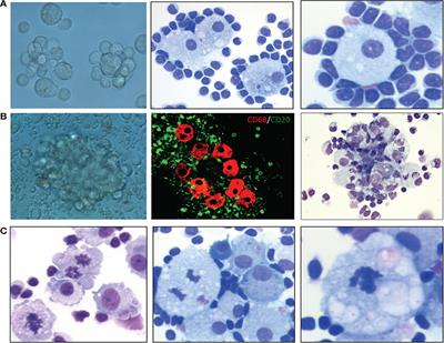 The Role of Macrophage/B-Cell Interactions in the Pathophysiology of B-Cell Lymphomas